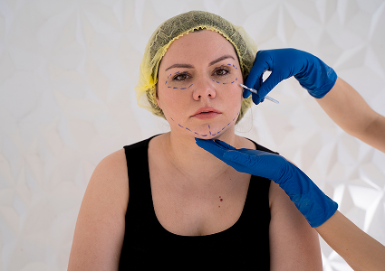 fat grafting for facial voluminising