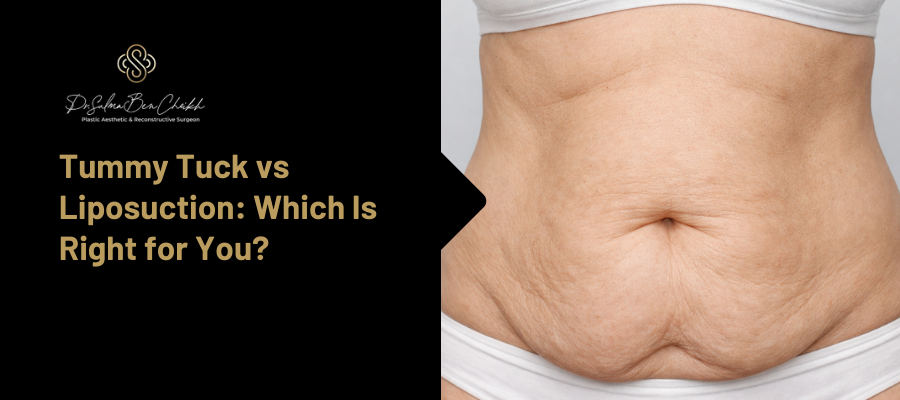 tummy tuck vs liposuction
