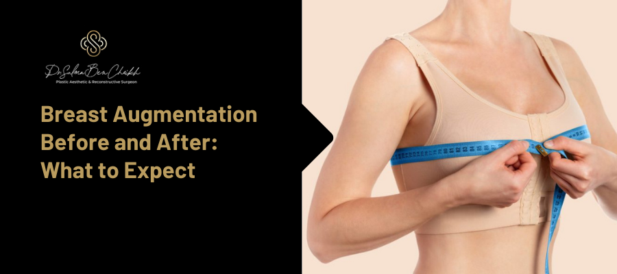 breast augmentation before and after