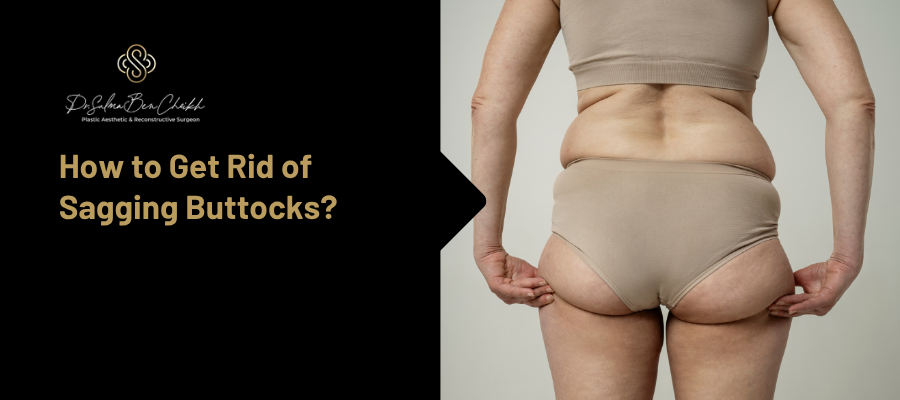 sagging buttocks