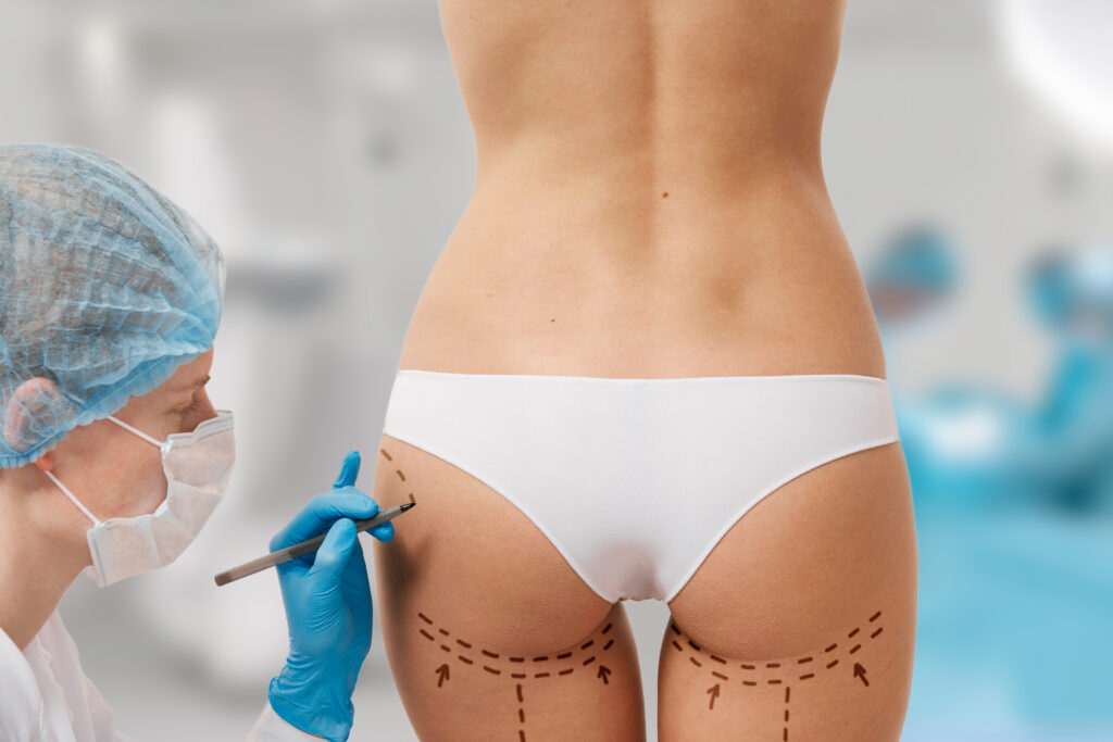 how to firm sagging buttocks